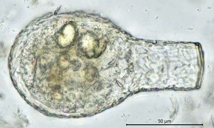 Padaungiella lageniformis